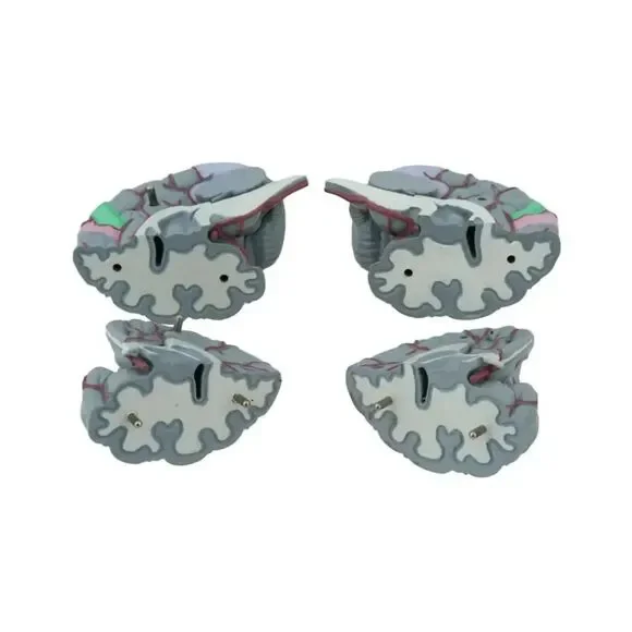 Life Size Human Brain Model - Medical Teaching (w/ 4 sections) EUC - Picture 7 of 10